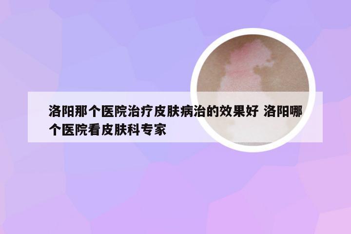 洛阳那个医院治疗皮肤病治的效果好 洛阳哪个医院看皮肤科专家