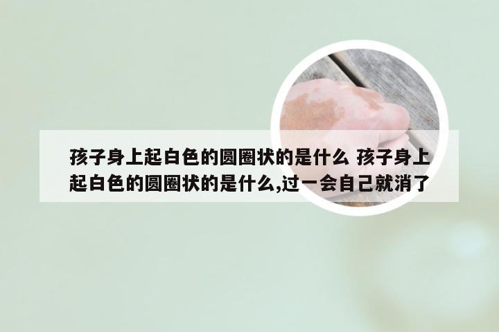 孩子身上起白色的圆圈状的是什么 孩子身上起白色的圆圈状的是什么,过一会自己就消了
