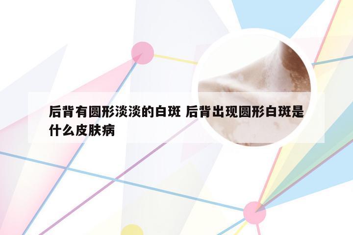 后背有圆形淡淡的白斑 后背出现圆形白斑是什么皮肤病