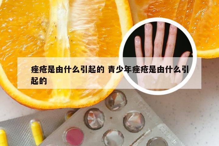 痤疮是由什么引起的 青少年痤疮是由什么引起的