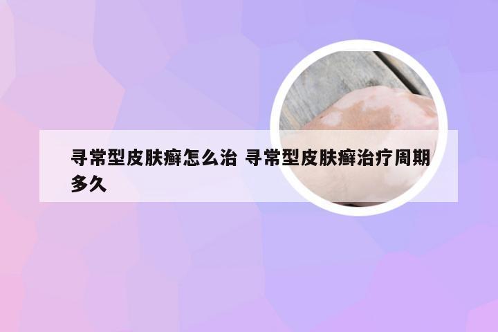 寻常型皮肤癣怎么治 寻常型皮肤癣治疗周期多久