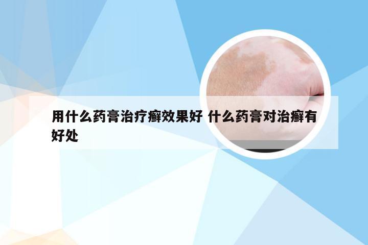 用什么药膏治疗癣效果好 什么药膏对治癣有好处