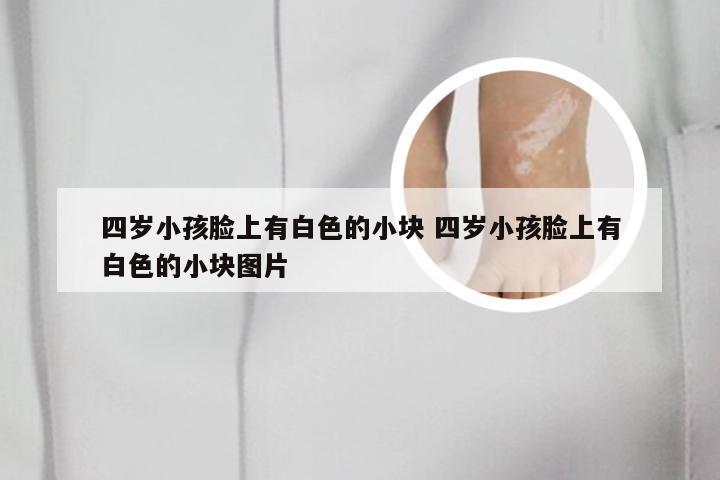 四岁小孩脸上有白色的小块 四岁小孩脸上有白色的小块图片