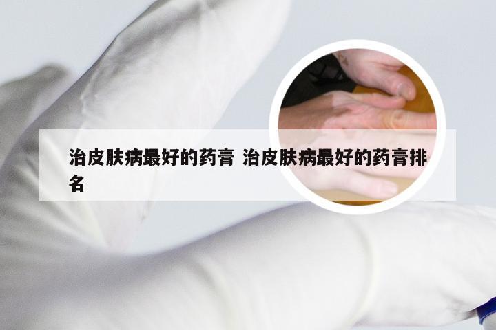 治皮肤病最好的药膏 治皮肤病最好的药膏排名