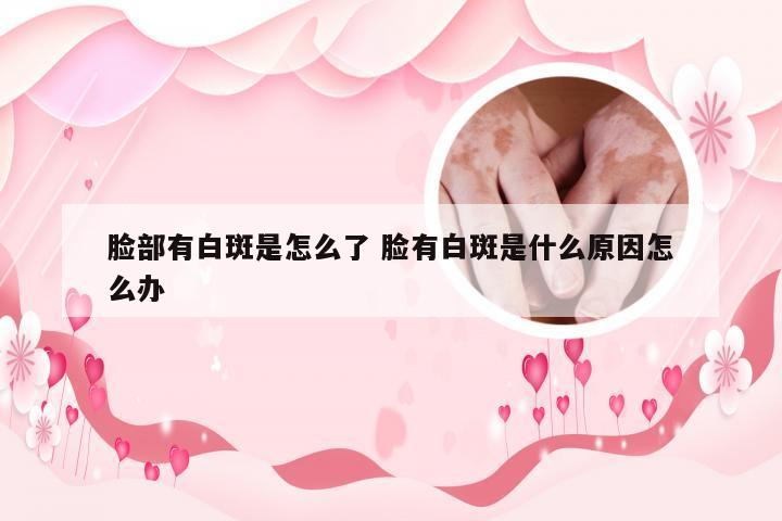 脸部有白斑是怎么了 脸有白斑是什么原因怎么办