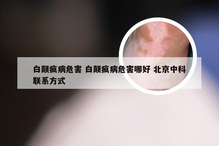 白颠疯病危害 白颠疯病危害哪好 北京中科联系方式