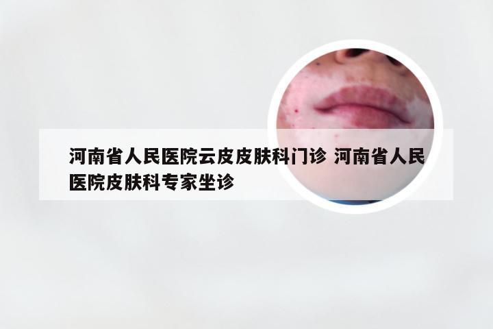 河南省人民医院云皮皮肤科门诊 河南省人民医院皮肤科专家坐诊