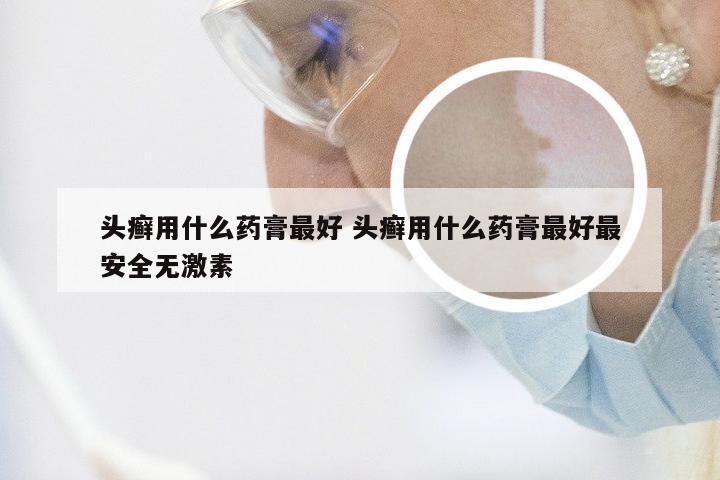 头癣用什么药膏最好 头癣用什么药膏最好最安全无激素