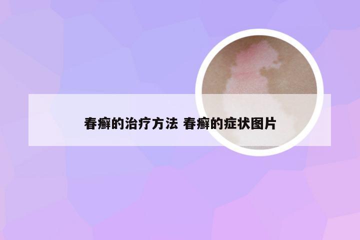 春癣的治疗方法 春癣的症状图片