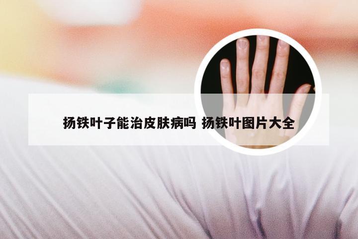 扬铁叶子能治皮肤病吗 扬铁叶图片大全