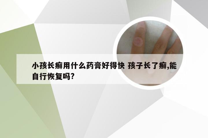 小孩长癣用什么药膏好得快 孩子长了癣,能自行恢复吗?