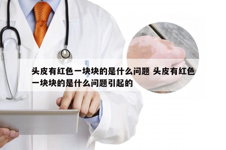 头皮有红色一块块的是什么问题 头皮有红色一块块的是什么问题引起的