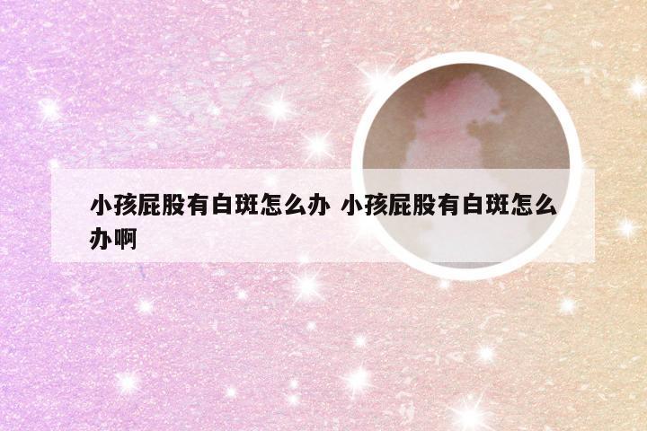 小孩屁股有白斑怎么办 小孩屁股有白斑怎么办啊