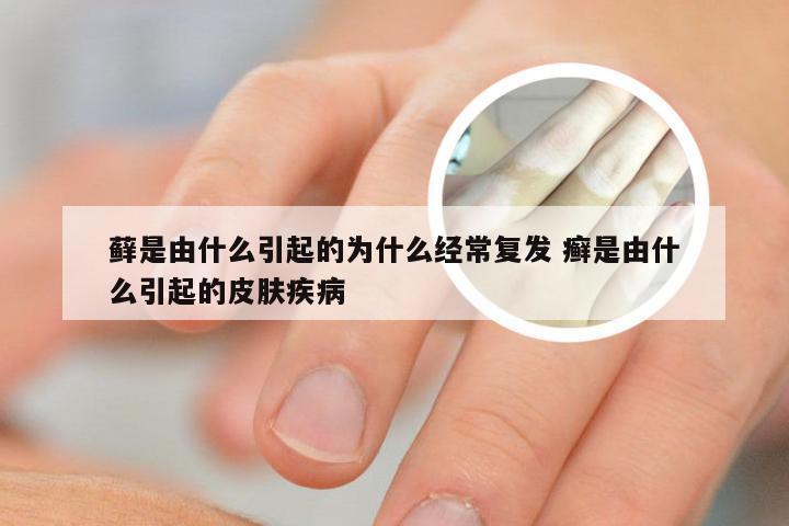 藓是由什么引起的为什么经常复发 癣是由什么引起的皮肤疾病
