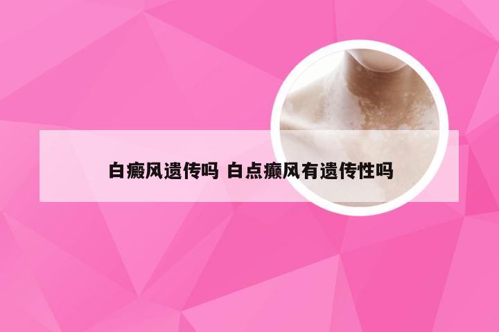 白癜风遗传吗 白点癫风有遗传性吗