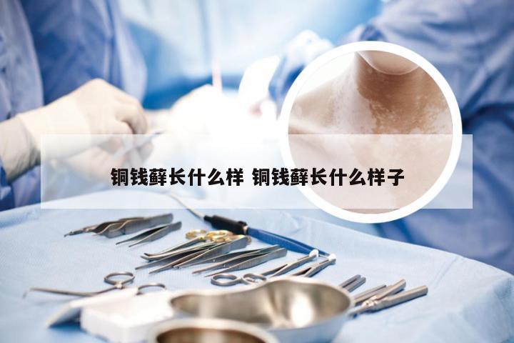 铜钱藓长什么样 铜钱藓长什么样子