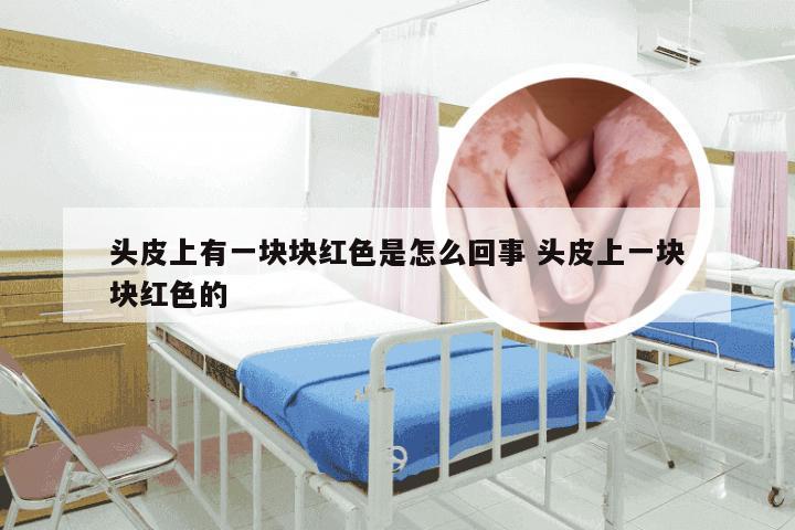 头皮上有一块块红色是怎么回事 头皮上一块块红色的