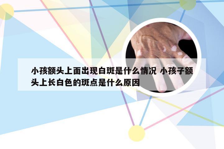 小孩额头上面出现白斑是什么情况 小孩子额头上长白色的斑点是什么原因
