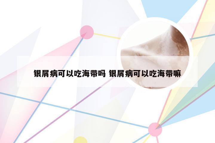 银屑病可以吃海带吗 银屑病可以吃海带嘛