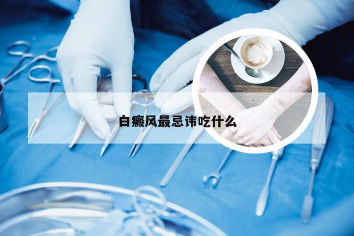白癜风最忌讳吃什么