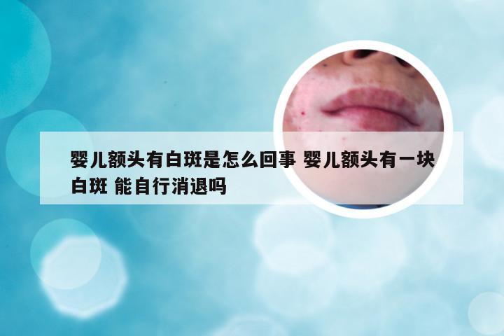 婴儿额头有白斑是怎么回事 婴儿额头有一块白斑 能自行消退吗
