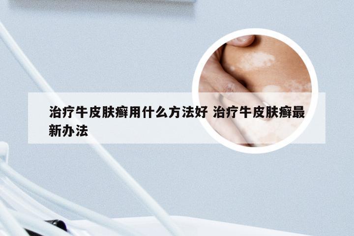治疗牛皮肤癣用什么方法好 治疗牛皮肤癣最新办法