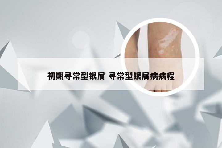 初期寻常型银屑 寻常型银屑病病程