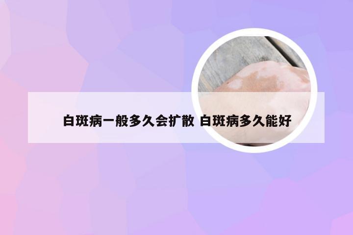 白斑病一般多久会扩散 白斑病多久能好