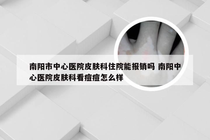 南阳市中心医院皮肤科住院能报销吗 南阳中心医院皮肤科看痘痘怎么样