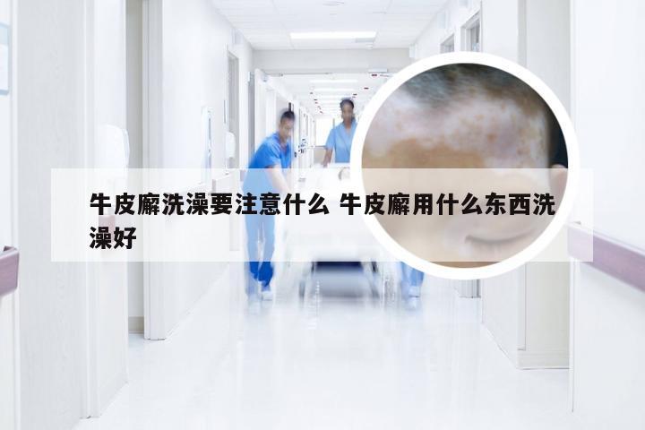 牛皮廨洗澡要注意什么 牛皮廨用什么东西洗澡好