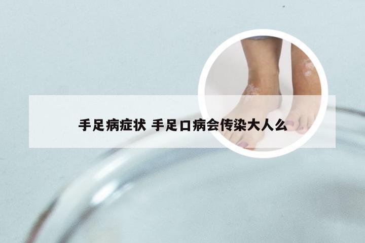 手足病症状 手足口病会传染大人么