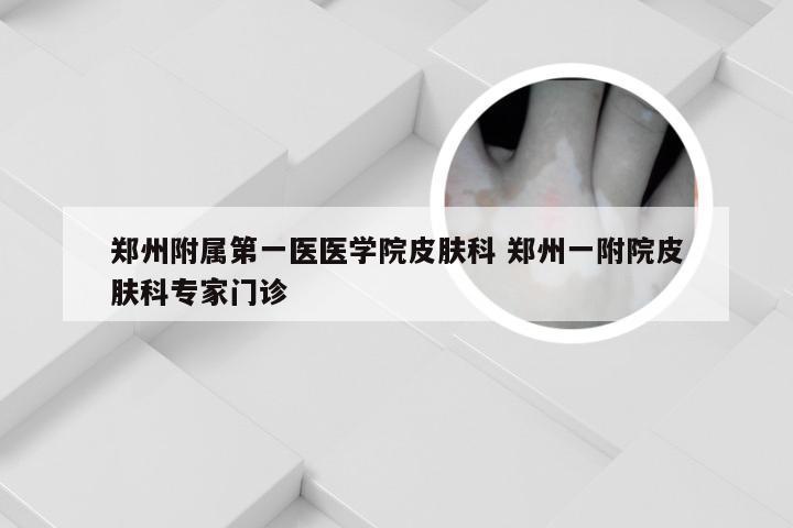 郑州附属第一医医学院皮肤科 郑州一附院皮肤科专家门诊