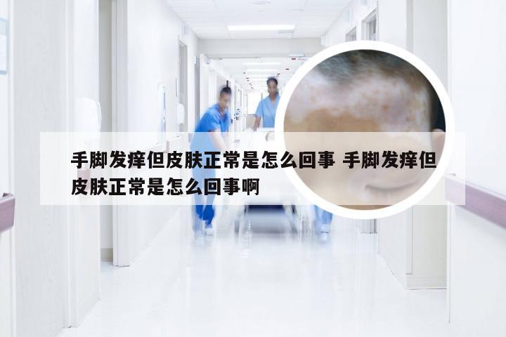 手脚发痒但皮肤正常是怎么回事 手脚发痒但皮肤正常是怎么回事啊