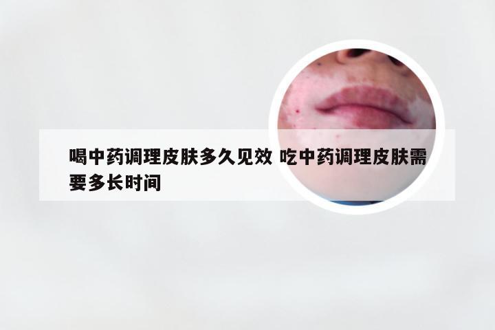 喝中药调理皮肤多久见效 吃中药调理皮肤需要多长时间