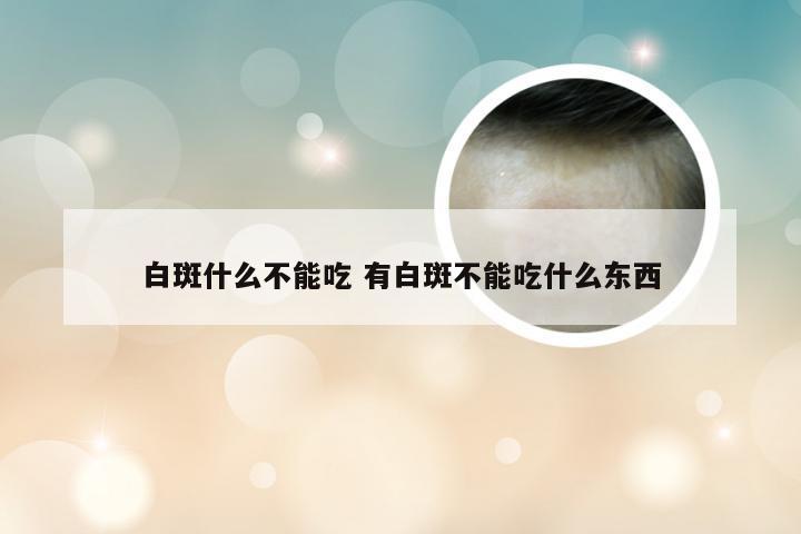 白斑什么不能吃 有白斑不能吃什么东西