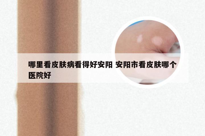 哪里看皮肤病看得好安阳 安阳市看皮肤哪个医院好