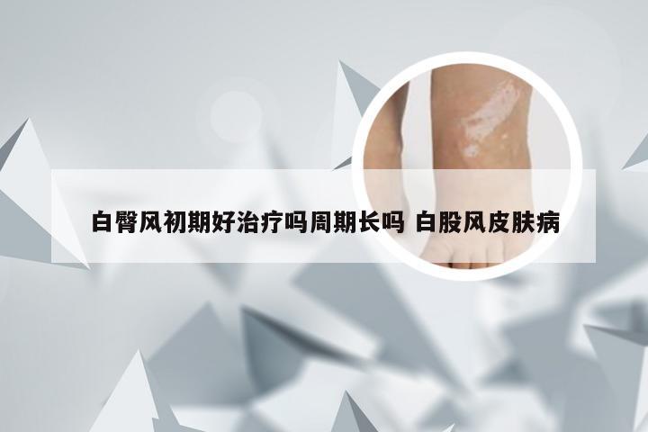 白臀风初期好治疗吗周期长吗 白股风皮肤病