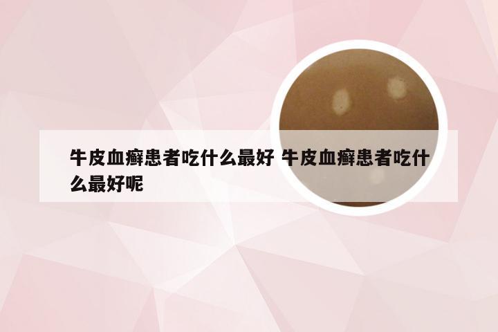 牛皮血癣患者吃什么最好 牛皮血癣患者吃什么最好呢