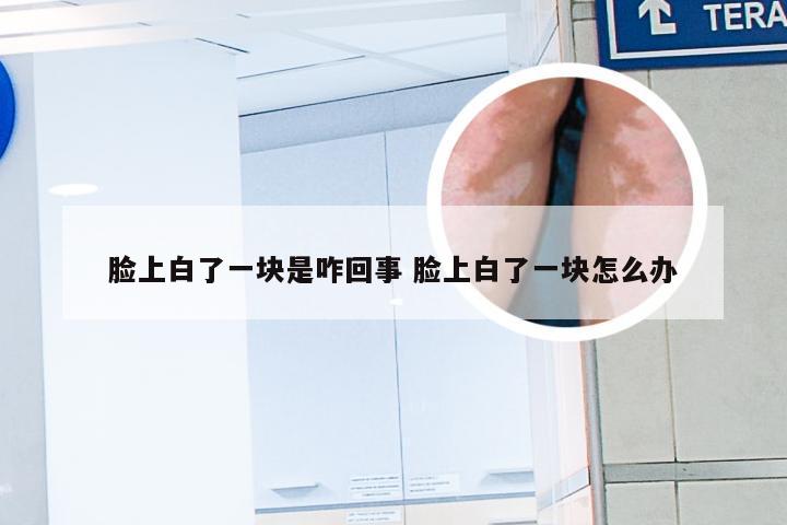 脸上白了一块是咋回事 脸上白了一块怎么办