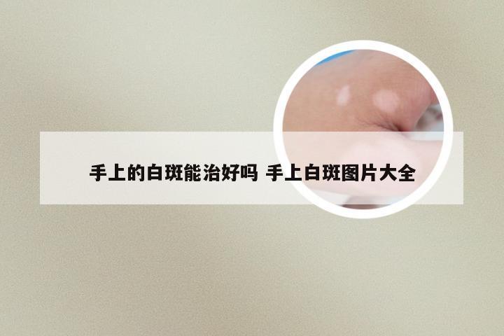 手上的白斑能治好吗 手上白斑图片大全