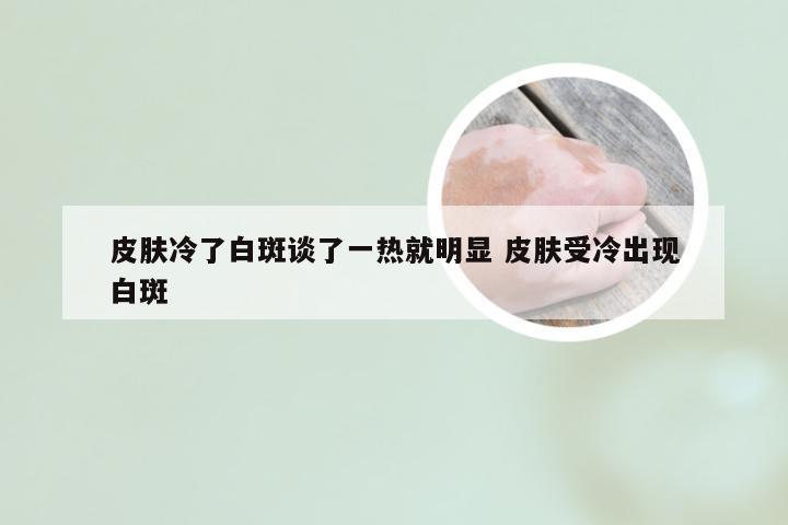 皮肤冷了白斑谈了一热就明显 皮肤受冷出现白斑