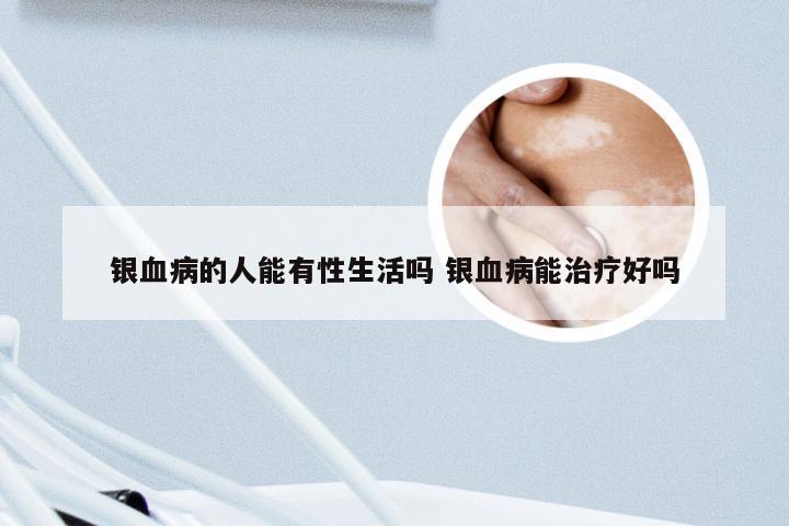 银血病的人能有性生活吗 银血病能治疗好吗