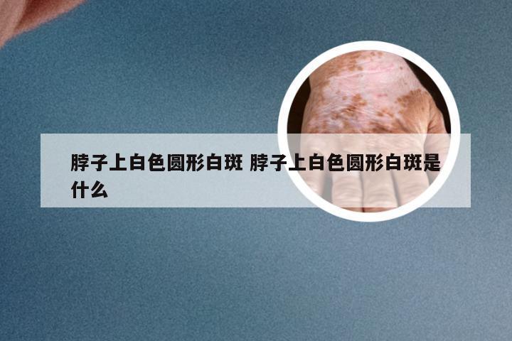脖子上白色圆形白斑 脖子上白色圆形白斑是什么