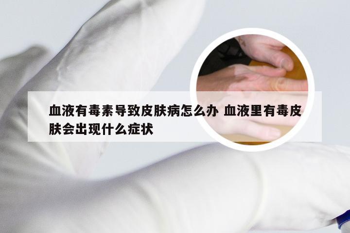 血液有毒素导致皮肤病怎么办 血液里有毒皮肤会出现什么症状