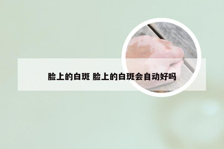 脸上的白斑 脸上的白斑会自动好吗