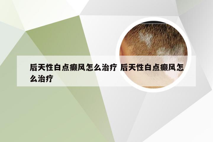 后天性白点癫风怎么治疗 后天性白点癫风怎么治疗