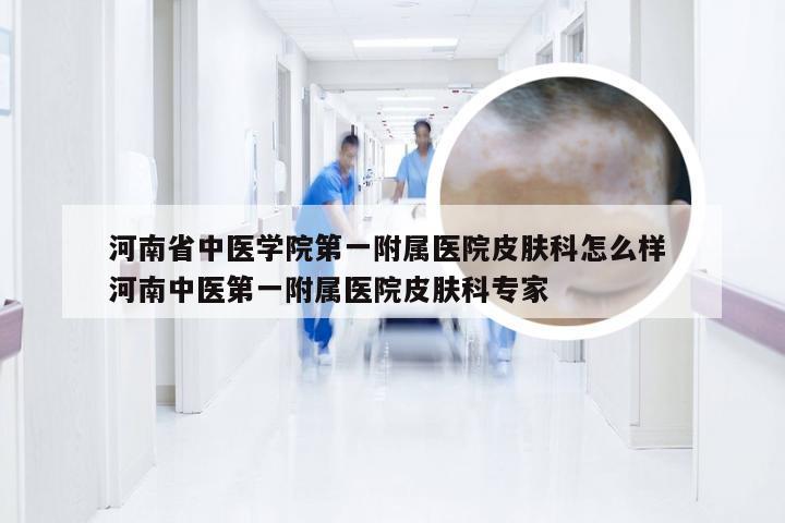 河南省中医学院第一附属医院皮肤科怎么样 河南中医第一附属医院皮肤科专家