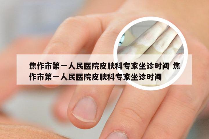 焦作市第一人民医院皮肤科专家坐诊时间 焦作市第一人民医院皮肤科专家坐诊时间