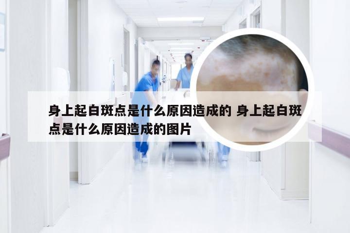 身上起白斑点是什么原因造成的 身上起白斑点是什么原因造成的图片