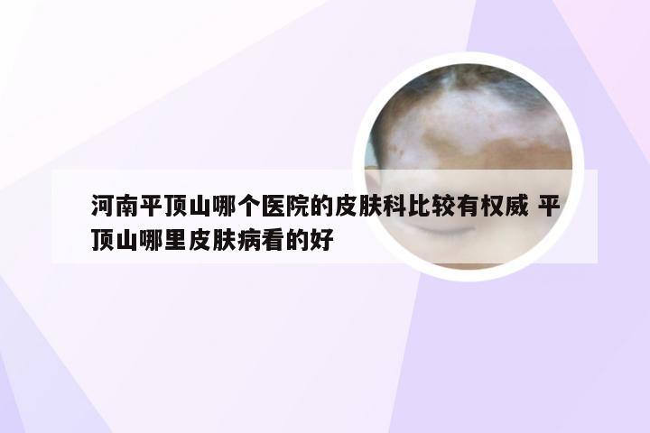 河南平顶山哪个医院的皮肤科比较有权威 平顶山哪里皮肤病看的好